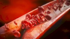 Создан препарат для подавления высокого уровня холестерина