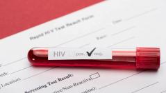 Шестой человек в мире излечился от ВИЧ, но есть один нюанс