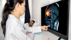 Разработан новый инструмент для снижения риска инсульта