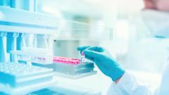 Российские ученые создали вещество, блокирующее развитие болезни Альцгеймера