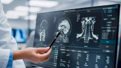 В России разработали способ диагностики опухолей мозга со 100% точностью