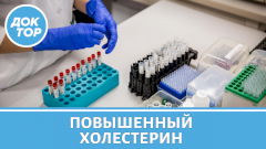 Холестерин: анализы, статины и альтернативы им