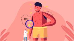 Корь и ветрянка: что важно знать