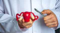 Гинеколог перечислила вероятные причины развития миомы
