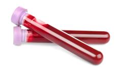 Стало известно, как влияет резус-фактор на течение коронавирусной инфекции