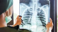 У школьницы лопнуло легкое из-за вейпинга