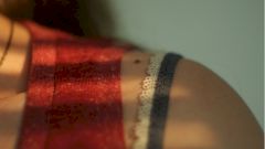 Врач рассказала, опасны ли красные родинки