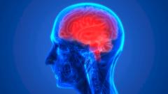 Назван еще один мощный инструмент для предотвращения инсульта