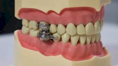 Разработан гаджет для похудения, с которым физически невозможно жевать