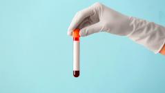 Новый анализ крови может предсказать риск развития шизофрении