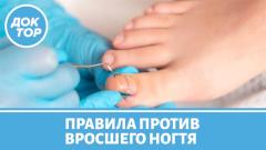 Чем опасен вросший ноготь / Как его правильно лечить