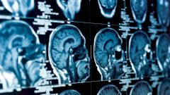 У казанского стрелка диагностировали заболевание мозга