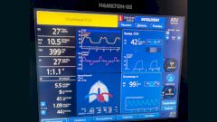 Проценко раскрыл статистику выживаемости на аппаратах ИВЛ