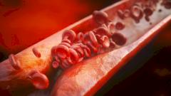 Ученые открыли механизм образования тромбов при COVID-19