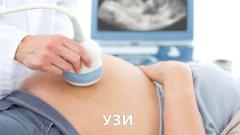 УЗИ