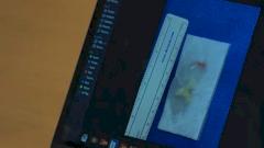 У американца достали из мозга прожившего там 10 лет червя