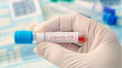 Количество случаев COVID-19 в России превысило полмиллиона