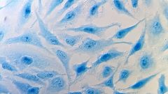 Бессмертные клетки Генриетты