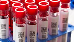 Американку полностью вылечили от ВИЧ с помощью стволовых клеток