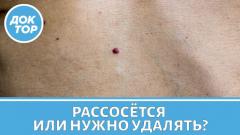 Гемангиома рассосётся сама или нужно лечить?