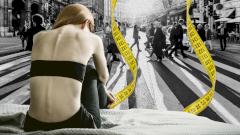 Анорексия, или Похудеть любой ценой