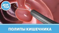 Как связаны колоректальный рак и полипы кишечника? Профилактика рака