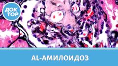 AL-АМИЛОИДОЗ: что важно знать