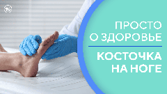 Какие упражнения помогут избавиться от косточки на ноге