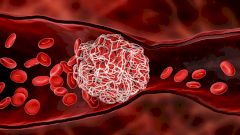 Описан механизм образования тромбов при вакцинации препаратами AstraZeneca и Johnson & Johnson