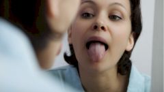 «Ковидный язык» признан еще одним симптомом коронавируса