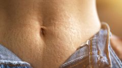 Как убрать растяжки на коже?