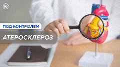 Кому для профилактики атеросклероза нужно принимать статины