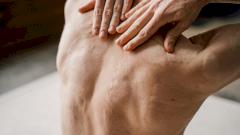 В России разработали технологию, повышающую эффективность лечения тяжелых ожогов