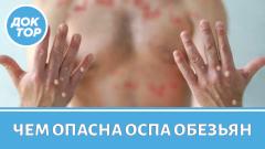 Как защитить себя и близких от обезьяньей оспы?