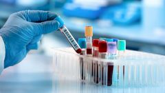 Эксперт рассказал, стоит ли тестироваться на антитела перед ревакцинацией