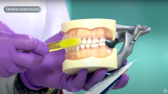 Гигиена полости рта