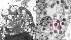 Появилось первое фото коронавируса омикрон-штамма